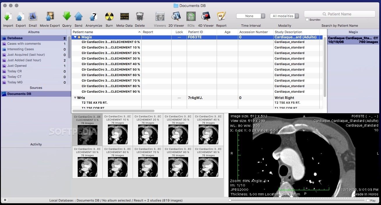 mergeorthopacstm v. 6.6 workstation cd viewer for mac
